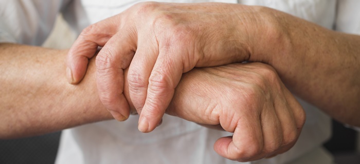 Artrite reumatoide: como aliviar as dores?